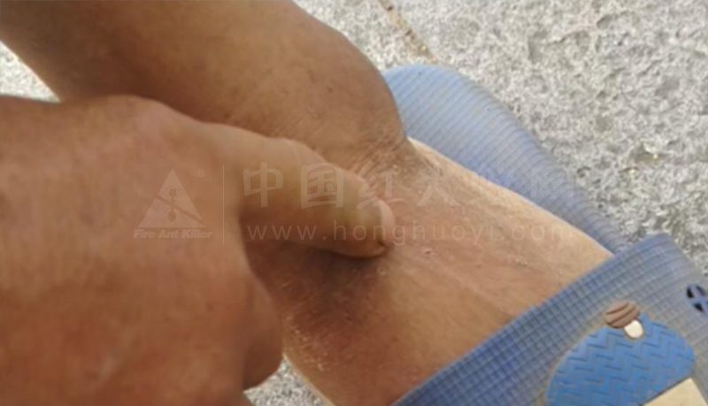 危险入侵生物!成都金堂现红火蚁 多人被咬